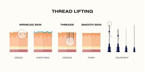 Thread Lift VS. Mini Facelift – A Considerable Comparison - Yastrid ...