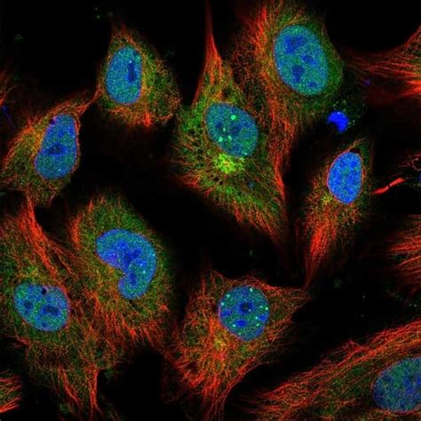 Anti Human Interleukin-6 Antibody | Bio-Rad