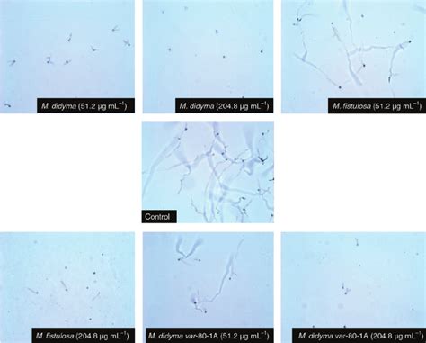 Light micrographs of conidia germination and germ tube length of... | Download Scientific Diagram