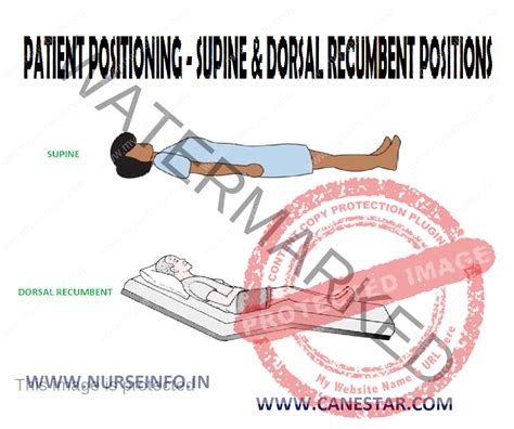 SUPINE & DORSAL RECUMBENT POSITION - Nurseinfo