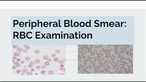 Red Blood Cell (RBC):- Part Normal Peripheral Blood Smear,, 58% OFF