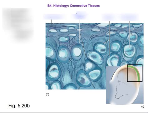 Elastic cartilage Diagram | Quizlet