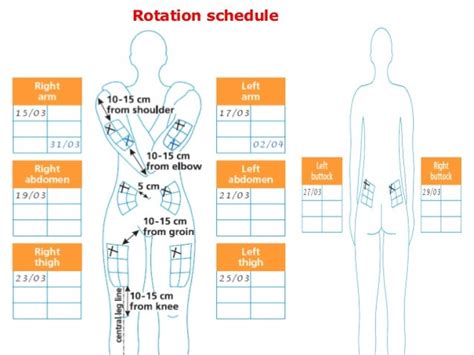 Printable Insulin Injection Sites Diagrams