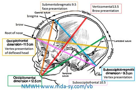 STUDY WITH FUN: diameters of fetal skull