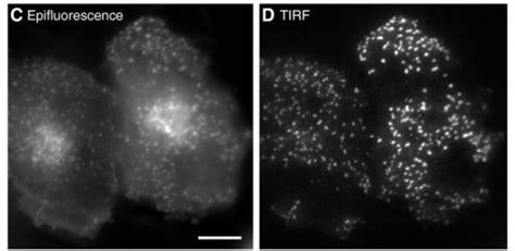 Total Internal Reflection Fluorescence (TIRF) Microscopy