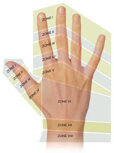 Emergency Department Management of Extensor Tendon Lacerations - ACEP Now