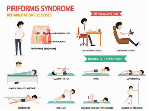 Relieve Piriformis Syndrome With Chiropractic Care