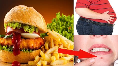 Fast Food Bad Health Effects | What Happens To Your Body When You Eat Too Much Fast Food ? - YouTube