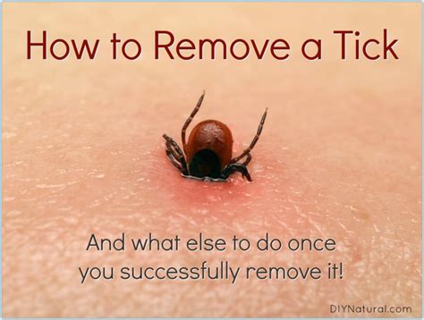 How to Remove A Tick: And What to Do Once You've Been Bitten