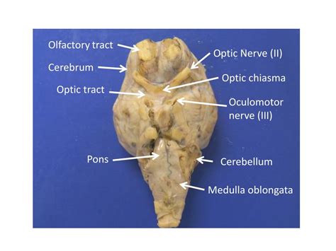 Sheep Brain Nerves Labeled