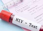 HIV News - Aids News, HIV Research News, Aids Research, HIV Research ...