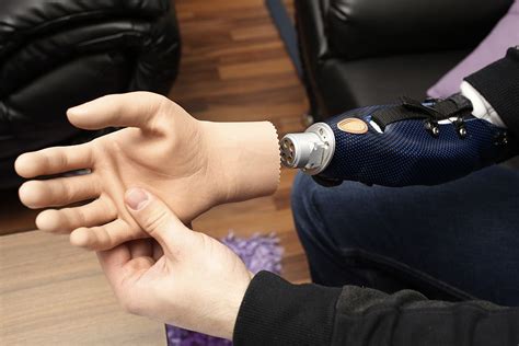 Revolutionary bionic hand brings back woman's ability to touch and 'feel'