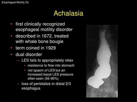 PPT - Esophageal Motility Disorders PowerPoint Presentation - ID:6701046