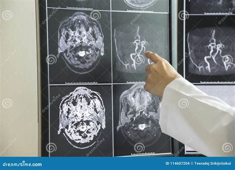 Doctor Pointing To Brain Anatomy on MRI Image Stock Photo - Image of exam, computer: 114607204