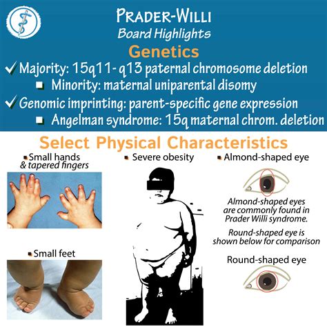 Clinical Pathology Glossary: Prader-Willi Syndrome | ditki medical ...