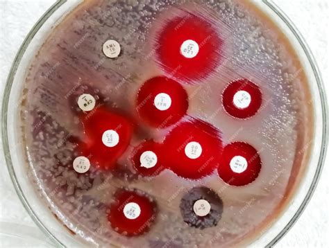 Premium Photo | Antimicrobial susceptibility testing in petri dish. Antibiotic resistance of ...