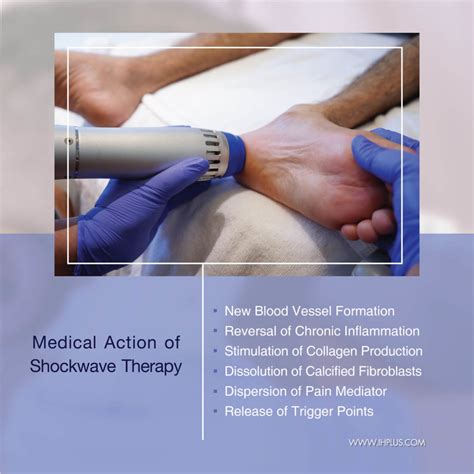 ShockWave Therapy - Intellihealth Plus Rejuvenation Clinic