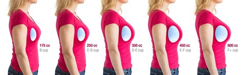 Premium Photo | Choosing the right size of breast implants for desired look