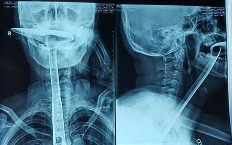 The 20 Weirdest X-Rays Known To Humankind