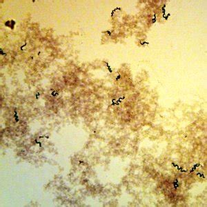 Low cost Bacterial Flagella-Polar Amphitrichous (Spirillum volutans), w.m. Microscope Slide ...