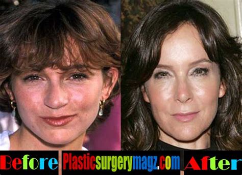 Jennifer Grey Plastic Surgery Before After Photos | Plastic Surgery ...