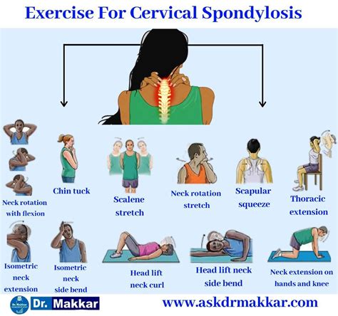 Neck Strengthening Exercises For Cervical Spondylosis - vrogue.co