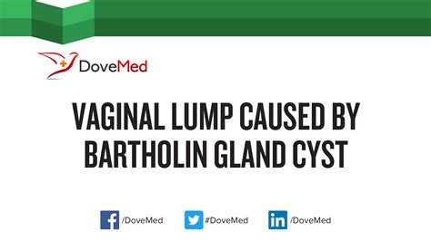 Vaginal Lump caused by Bartholin Gland Cyst