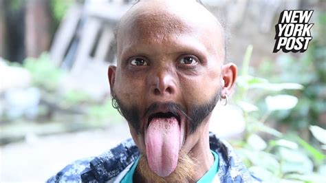 Man Can Lick His Own Forehead with 'World's Longest Tongue' | New York Post - YouTube