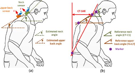 Figure 1 from Wearable Sensor Based Stooped Posture Estimation in ...