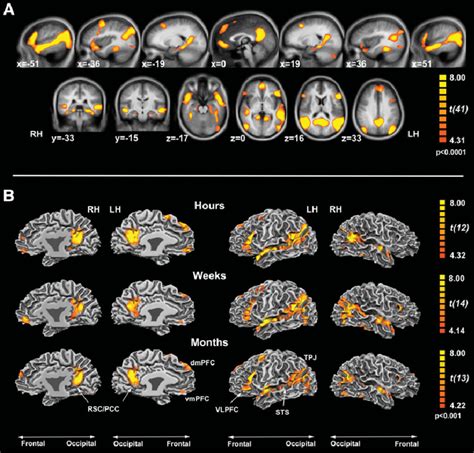 Brain system supporting episodic memory retrieval during mental recall ...