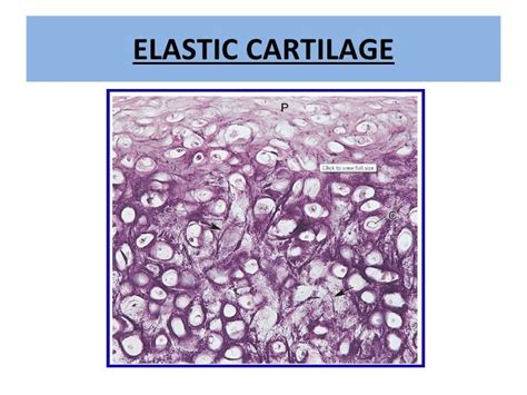 Cartilage