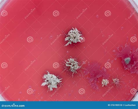 Colonies of microorganisms stock photo. Image of culture - 276190518