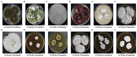 Aspergillus Nidulans Morphology