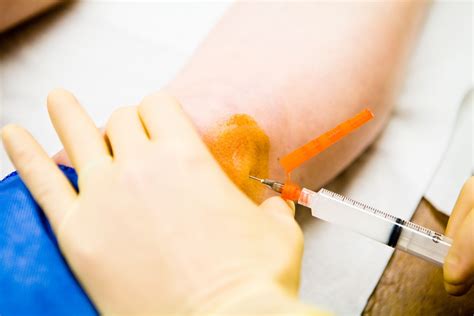 Cortisone Shots for Inflammation: Benefits, Side Effects