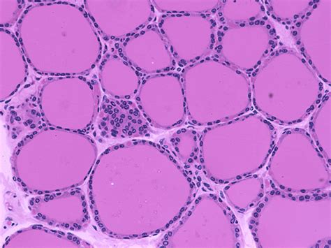 thyroid with folicles | Tissue types, Histology slides, Lab image