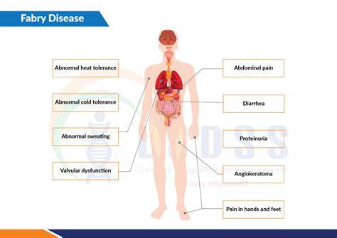 Fabry Disease | LSDSS India