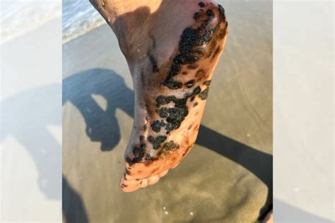 PICS: Oil pellets wash up on Mossel Bay beaches, forcing closures