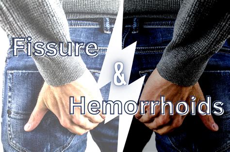 Know The Differences Between Anal Fissure And Hemorrhoids