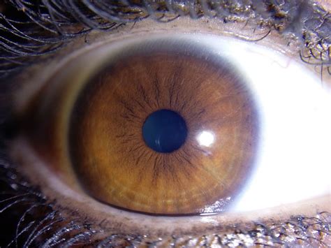 17 Best images about Iris patterns / Iridology on Pinterest | What's the, Colors and Eyes