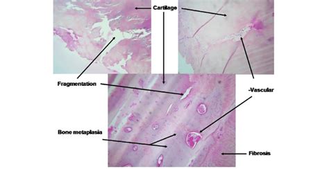 Histological analysis of explanted costal cartilage. | Download Scientific Diagram