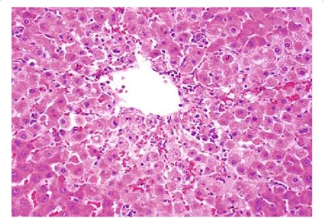 a: Marked hepatocellular necrosis in zonal, centrilobular pattern;... | Download Scientific Diagram