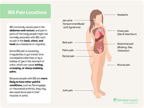 IBS Pain Guide: Types, Locations, and Treatments