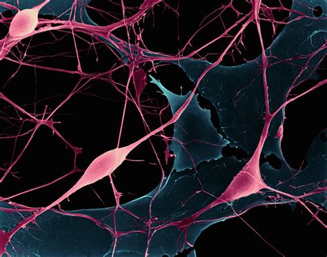 Pyramidal Neurons From Cns Photograph by Dennis Kunkel Microscopy/science Photo Library - Fine ...