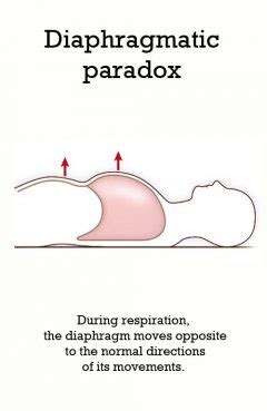 PARADOX PARKWAY