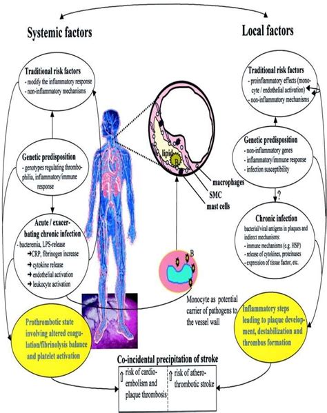 The relationship between inflammation and infection by vascular... | Download Scientific Diagram