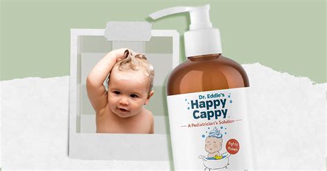 Best Cradle Cap Shampoo for Babies: Shop Our Favorite! | The Everymom