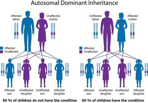 Pfeiffer syndrome causes, signs, symptoms, diagnosis & treatment