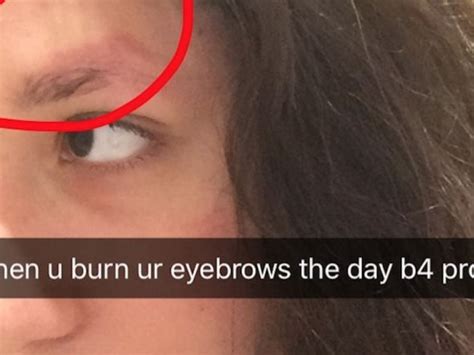 This Teen Burned Her Eyebrows Off The Day Before Prom, But Her Recovery Game Was On Point | SELF