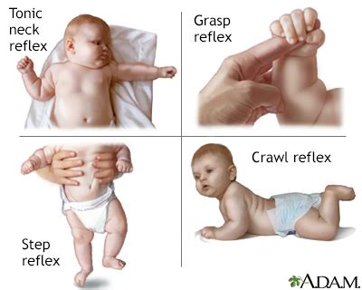 Infant reflexes Information | Mount Sinai - New York