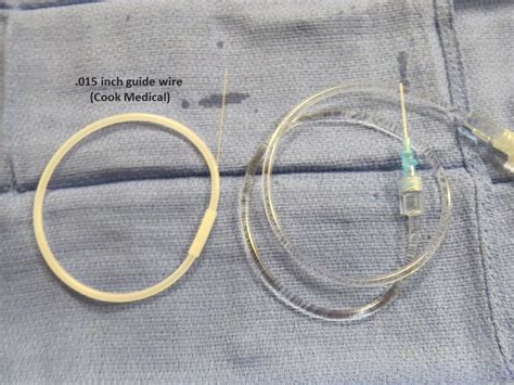 Sialogram Technique | Iowa Head and Neck Protocols